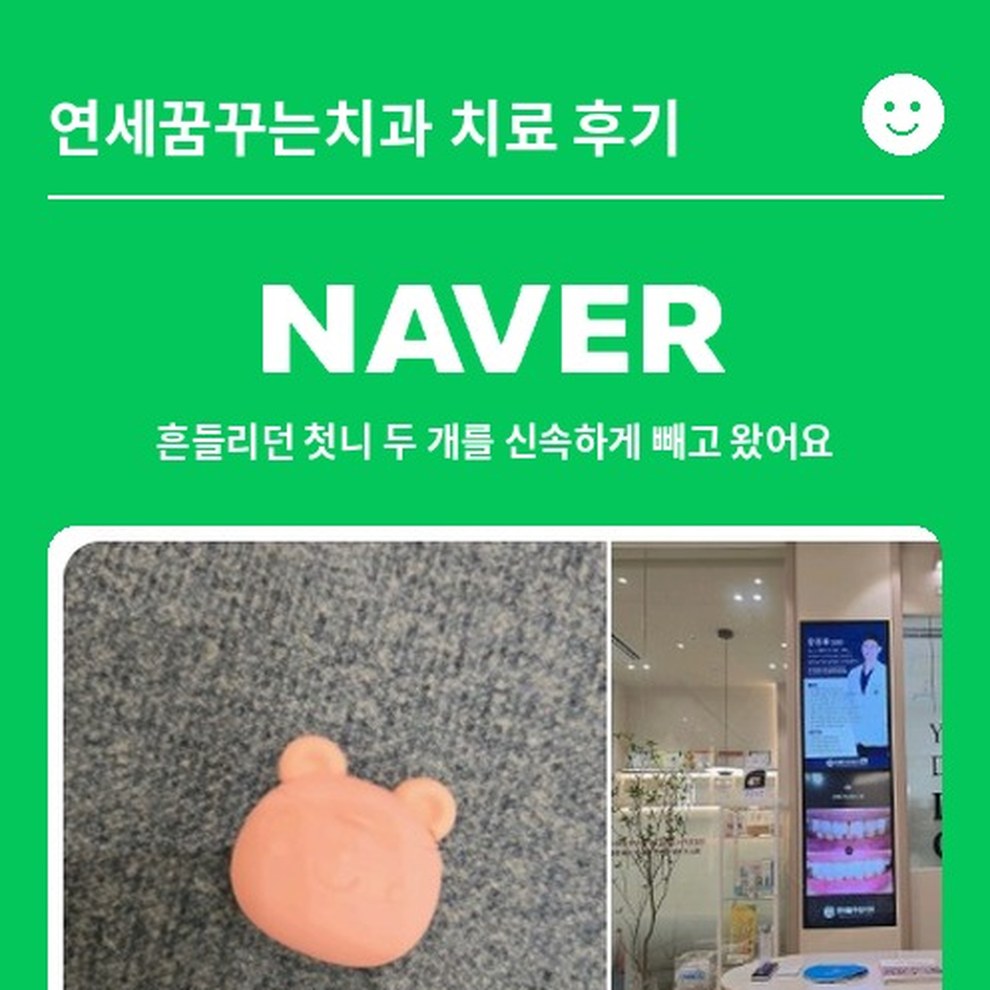 [소아] 흔들리던 첫니 두 개를 신속하게 빼고 왔어요｜길동 소아치과 후기